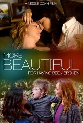 More Beautiful for Having Been Broken - Legendado  Download - Rede Torrent